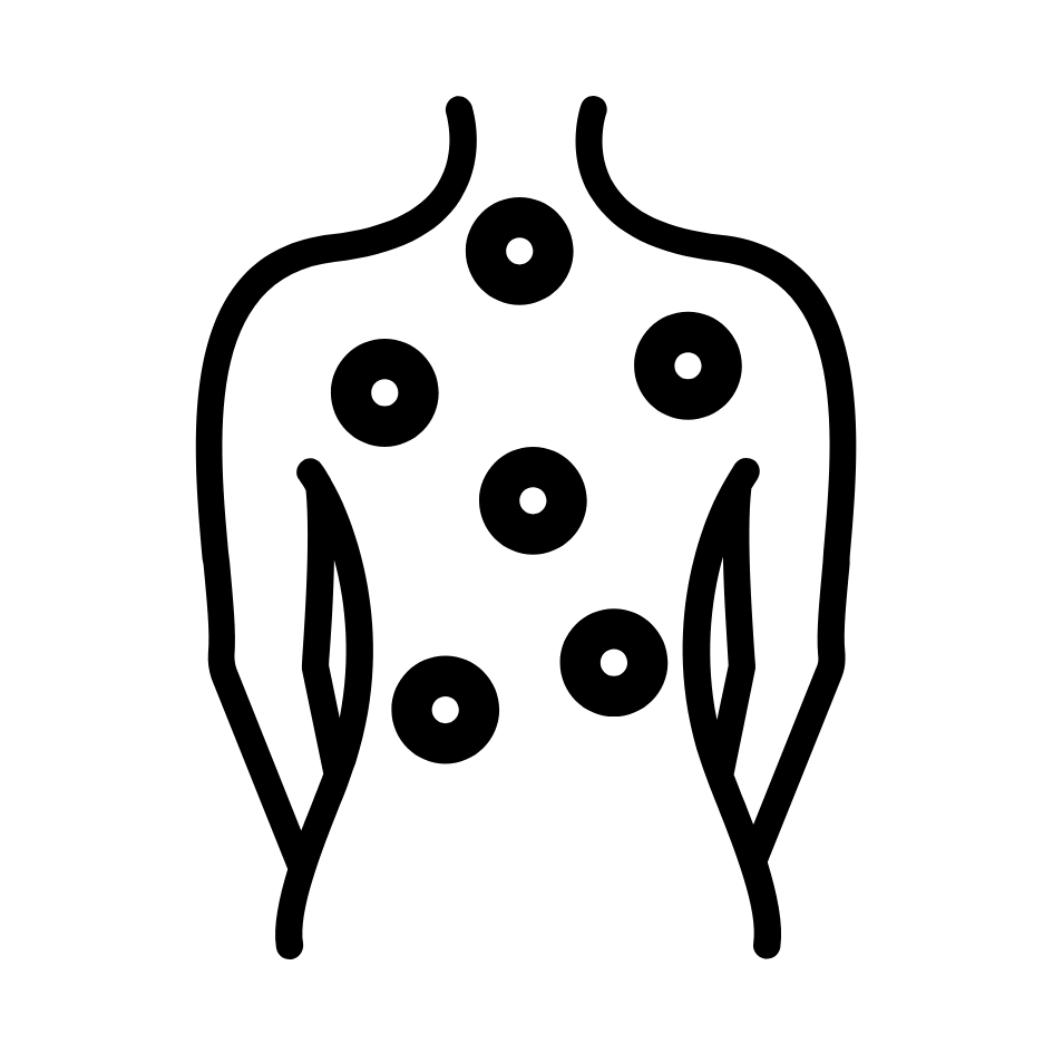 trigger point