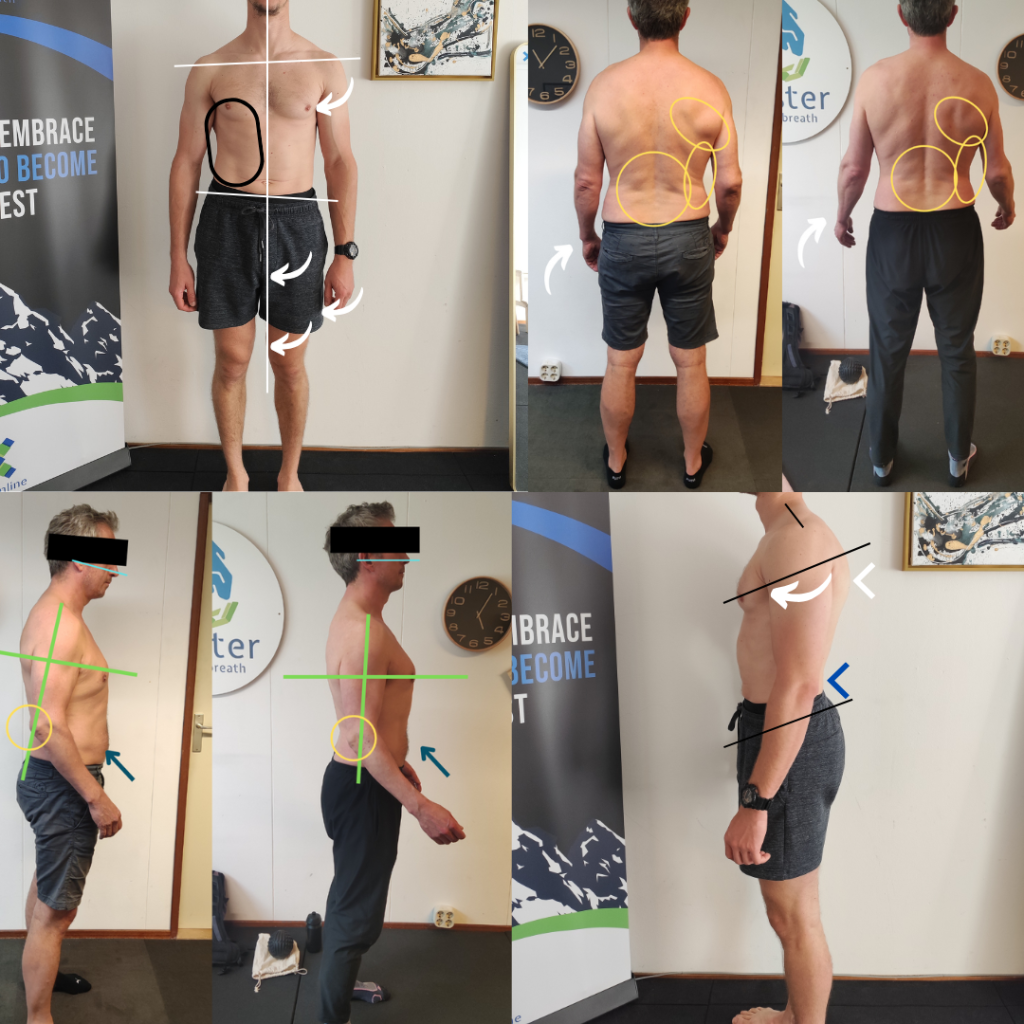posture correction posture correction
